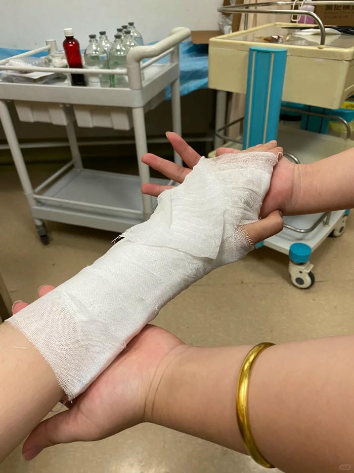 ảnh gãy tay 7