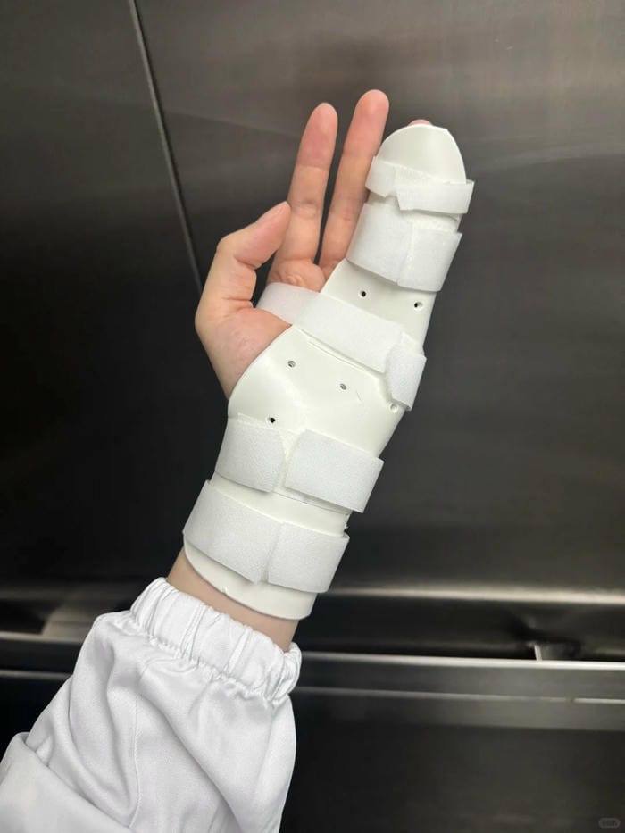 ảnh gãy tay 8