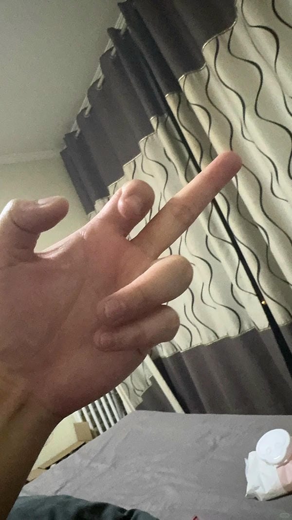 ảnh ngón giữa 8