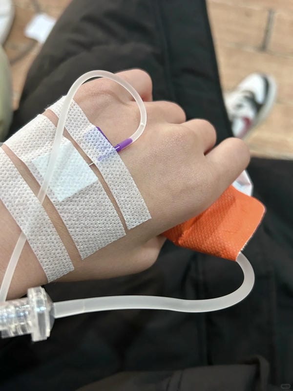 ảnh truyền nước ở tay nam 17