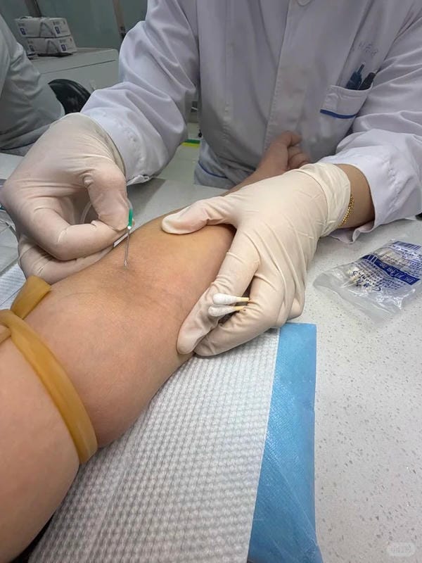 ảnh truyền nước ở tay nam 18