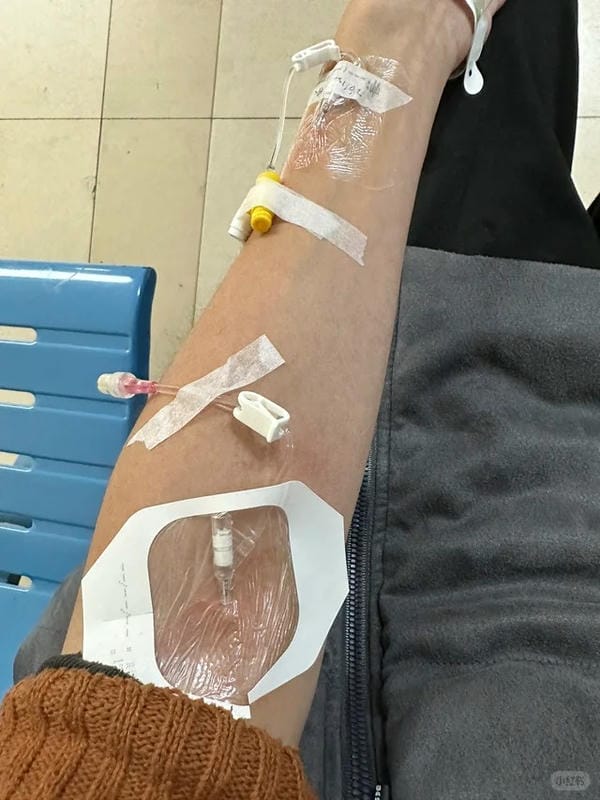 ảnh truyền nước ở tay nam 19