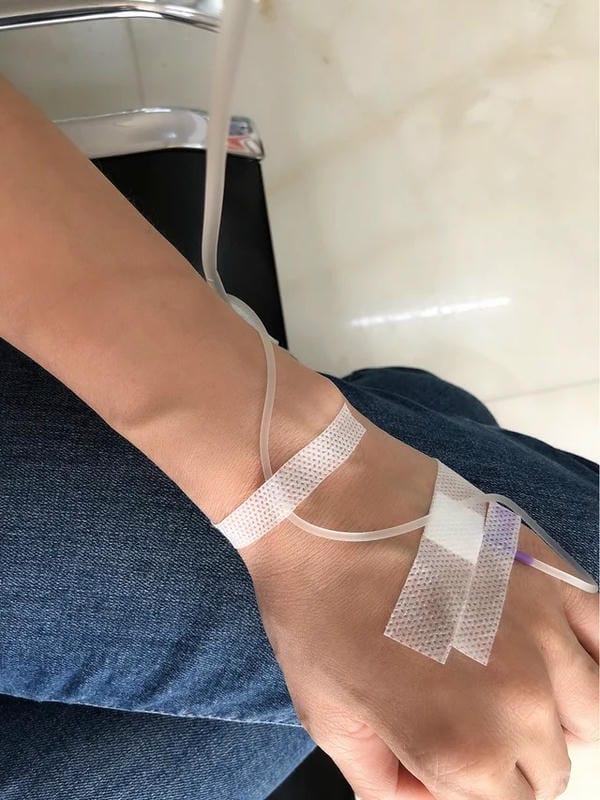 ảnh truyền nước ở tay nam 25