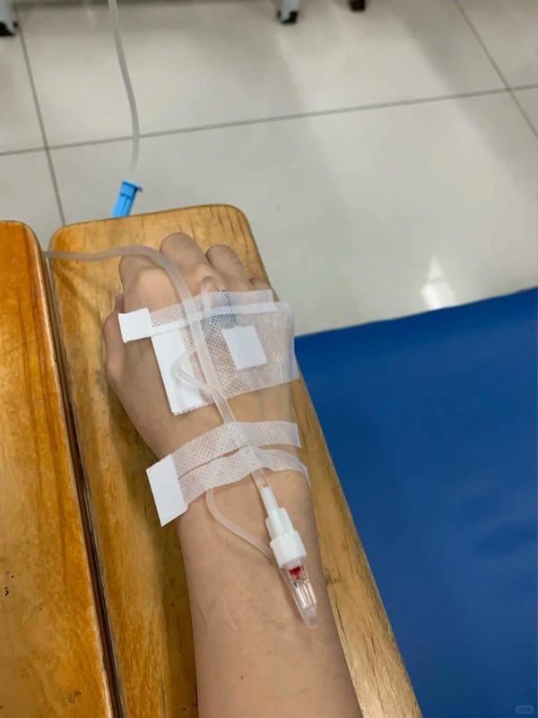 ảnh truyền nước ở tay nam 27