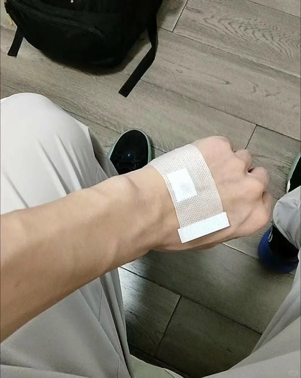 ảnh truyền nước ở tay nam 36