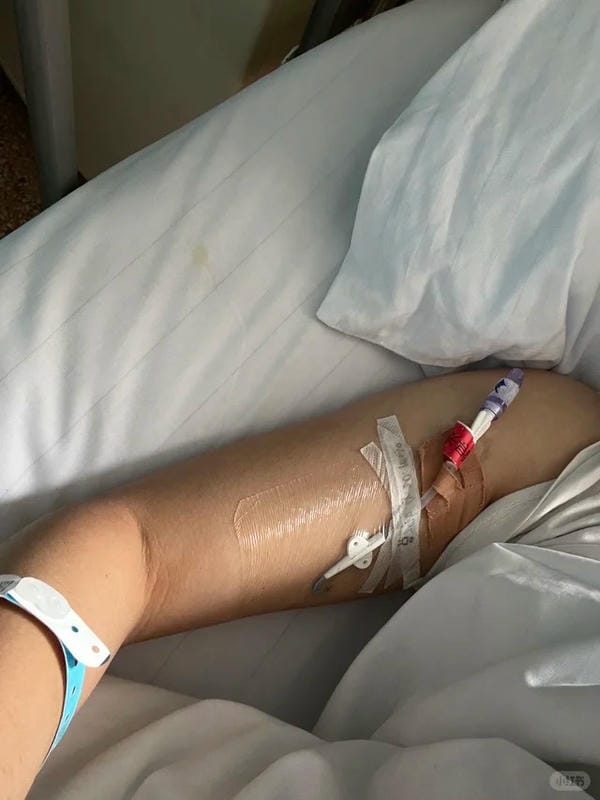 ảnh truyền nước ở tay nam 40