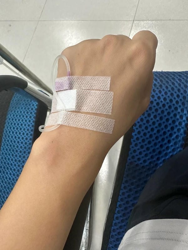 ảnh truyền nước ở tay nam 41