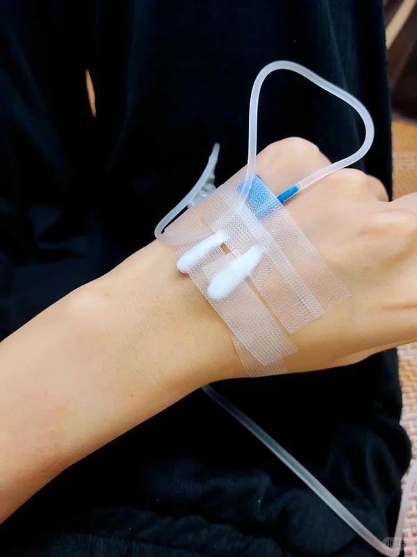 ảnh truyền nước ở tay nam 5