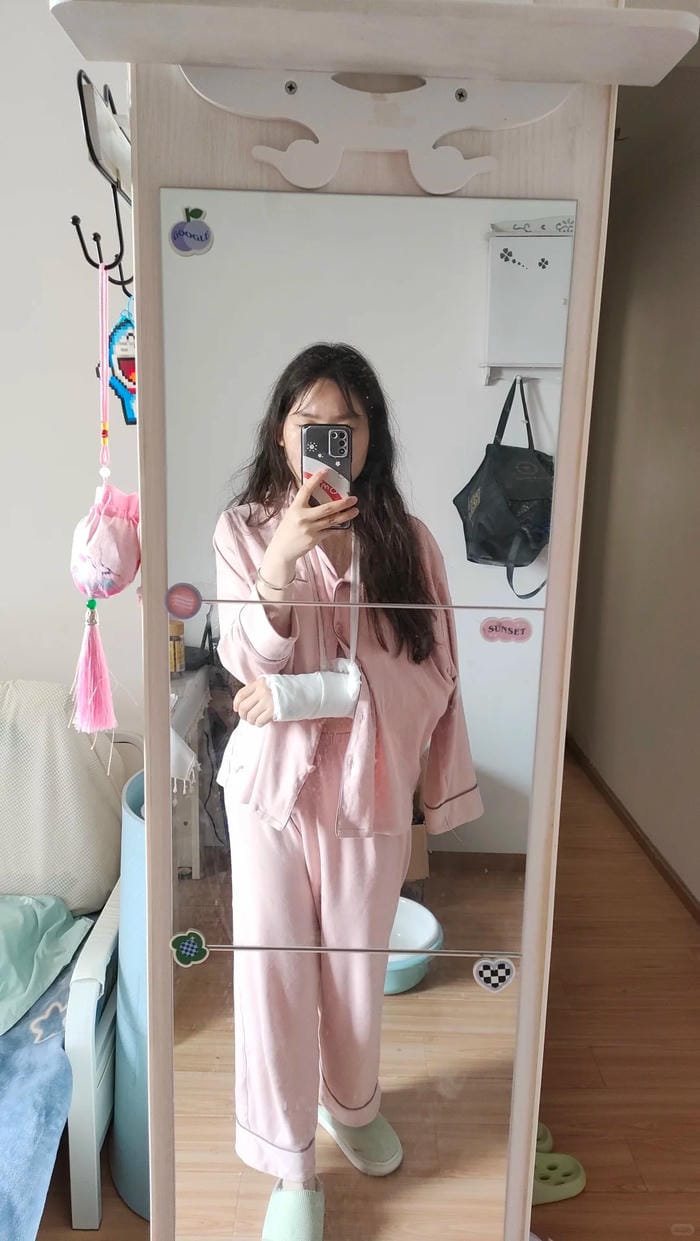 hình ảnh gãy tay